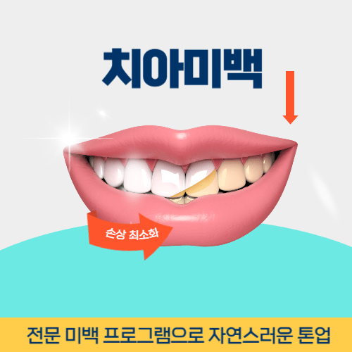 경주치과 경주시 치과 치아미백