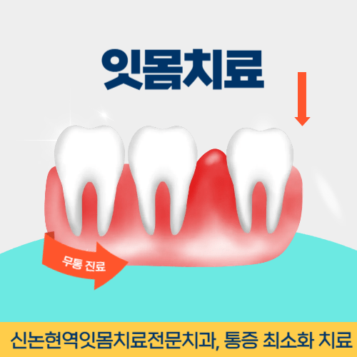 경주치과 경주시 치과 잇몸치료